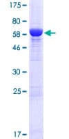Human ADPRHL1 Protein (Recombinant GST)
