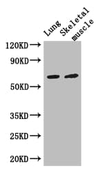 PAK3 Antibody