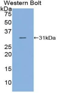 Complement C2 Antibody (aa245-451)