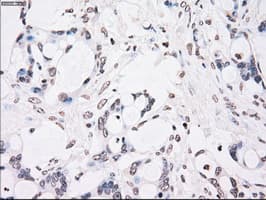Monoclonal Mouse anti-Human CHEK2 / CHK2 Antibody (clone OTI5C7, IHC, WB)