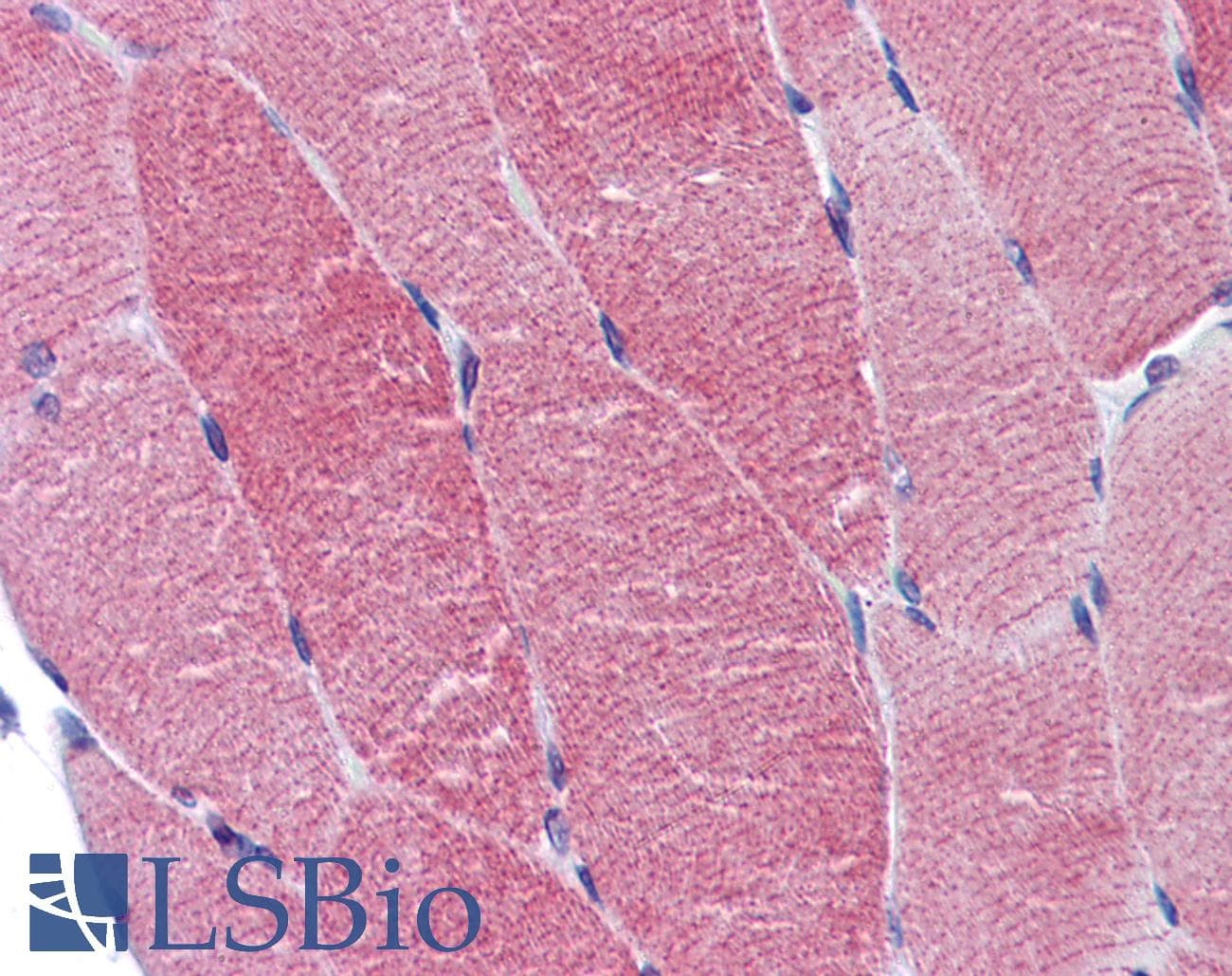 IHC-plus™ ACTN2 Antibody