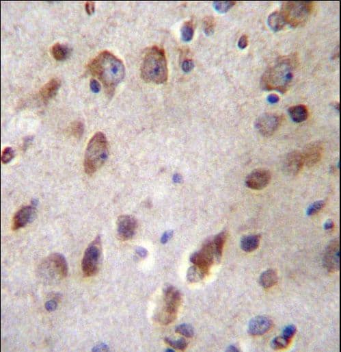 Polyclonal Rabbit anti-Human B4GAT1 / B3GNT1 Antibody (aa366-394, IHC, WB)