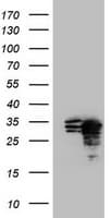 MORF4 Antibody (aa1-255, clone OTI2E4, Carrier-free)