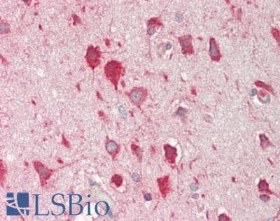 IHC-plus™ EEA1 Antibody (aa175-225)
