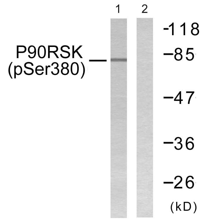 Polyclonal Rabbit anti-Human RPS6KA1 / RSK1 Antibody (phospho-Ser380, WB)