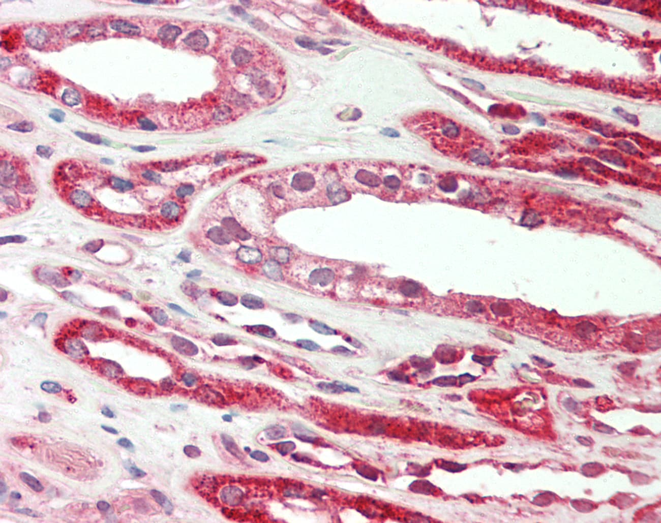 PLG / Plasmin / Plasminogen Antibody (aa611-660)