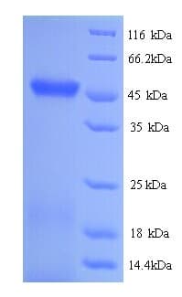 E. coli rtcB / RNA-Splicing Ligase Protein (Recombinant His)