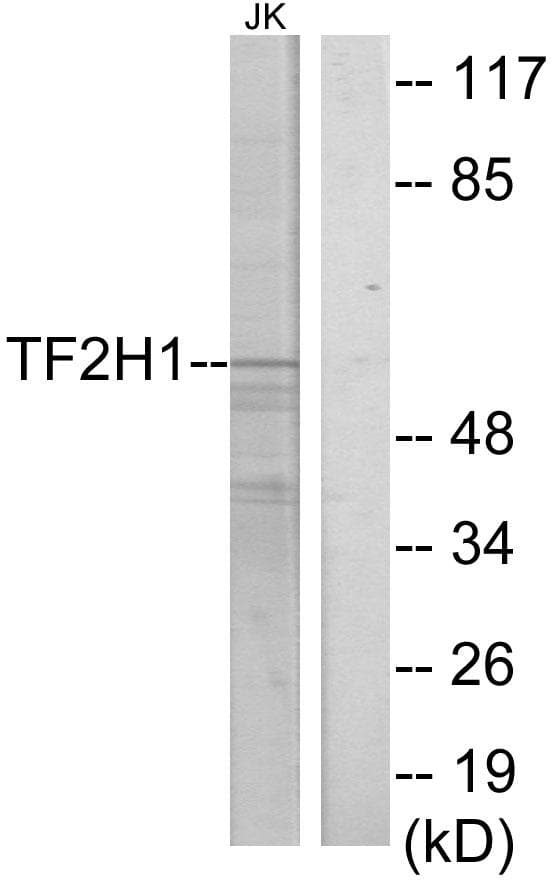TFB1 / GTF2H1 Antibody