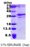 Human STYX Protein (Recombinant His)
