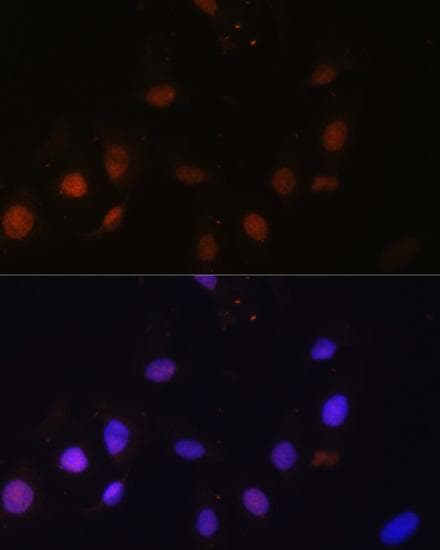 SNW1 / SKIP Antibody
