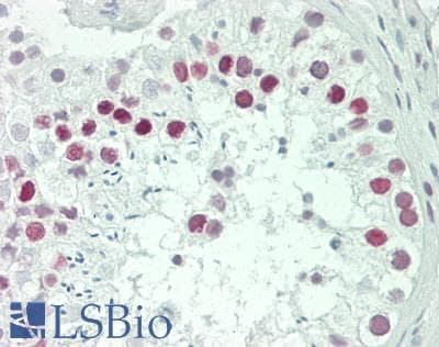 IHC-plus™ TPR Antibody (aa2300-C-term)
