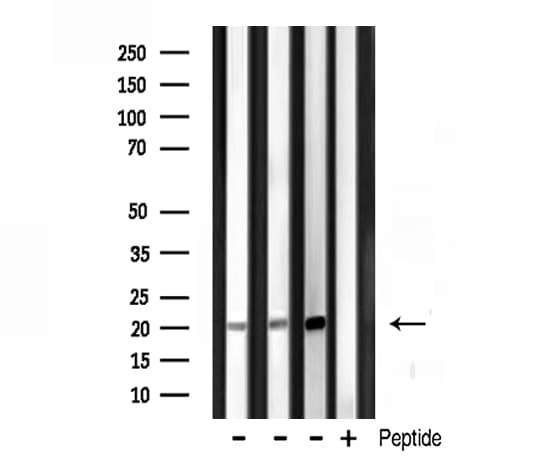 Polyclonal Rabbit anti-Human H1F0 Antibody (IF, WB)