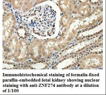 ZNF274 Antibody (aa278-484)