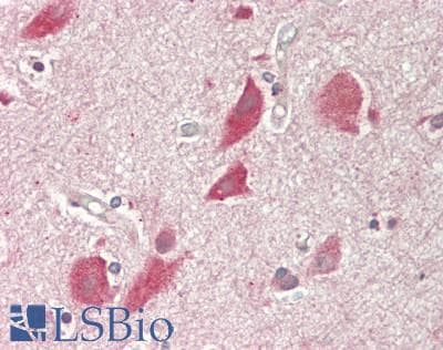 IHC-plus™ ARSA / Arylsulfatase A Antibody (220-300 aa, Internal)
