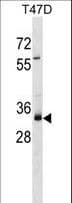 Polyclonal Rabbit anti-Human MYEOV Antibody (aa87-116, WB)