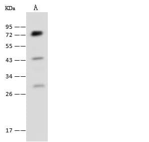 Polyclonal Rabbit anti-Human CYPOR / POR Antibody (IHC, WB)