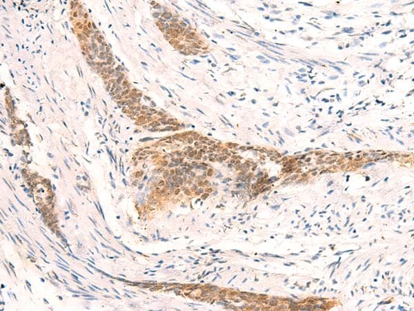 HSPA4L / APG-1 Antibody