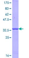 Human OTOF / Otoferlin Protein (Recombinant GST, N-terminus)