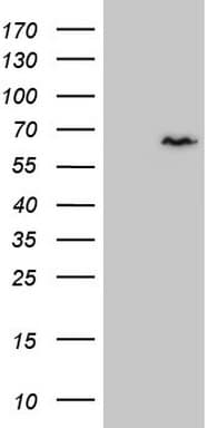 CCDC36 Antibody (clone OTI2F7)