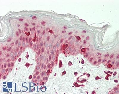 IHC-plus™ CTDP1 / FCP1 Antibody (aa911-961)