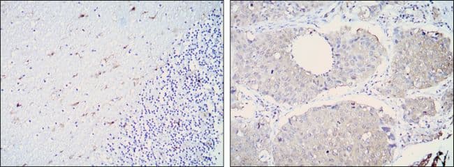 Monoclonal Mouse anti-Human ALDH1A1 / ALDH1 Antibody (clone 5A11, IHC, WB)