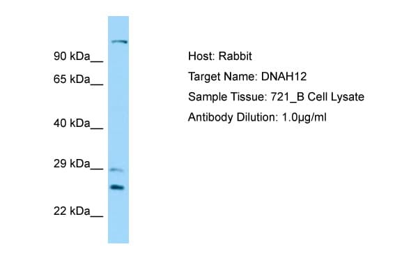 DNAH12 Antibody (aa91-140)