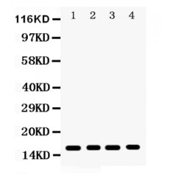 CENPA / CENP-A Antibody (aa1-140)