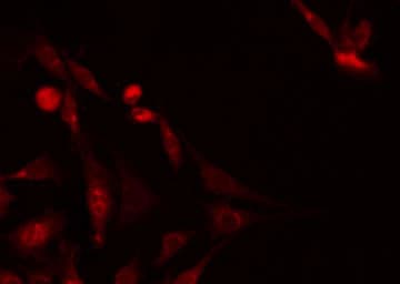 PRKAB1 / AMPK Beta 1 Antibody (phospho-Ser181)