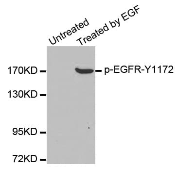 EGFR Antibody (phospho-Tyr1172)