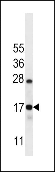 C15orf40 Antibody (aa72-100)