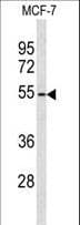 ADAMDEC1 Antibody (aa39-69)