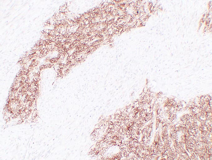 Monoclonal Mouse anti-Human CD99 Antibody (clone ABT-CD99, IHC)