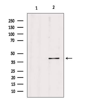 Polyclonal Rabbit anti-Human PGC / Pepsin C Antibody (IHC, IF, WB)