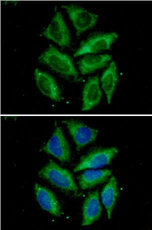 TOMM20 Antibody (clone AT1B2)