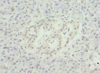 Polyclonal Rabbit anti-Human NMNAT1 / NMNAT Antibody (IHC)