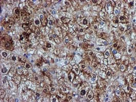 GSTT2 Antibody (clone OTI3B6)