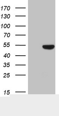 KRT16 / CK16 / Cytokeratin 16 Antibody (clone OTI1G5, Carrier-free)
