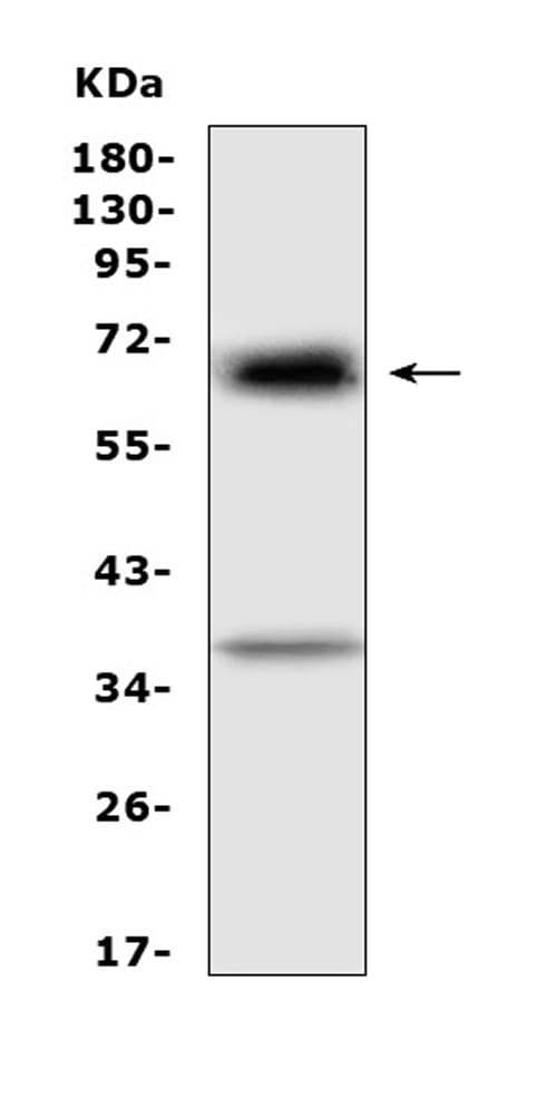 Polyclonal Rabbit anti-Mouse Alpha-Fetoprotein Antibody (WB)
