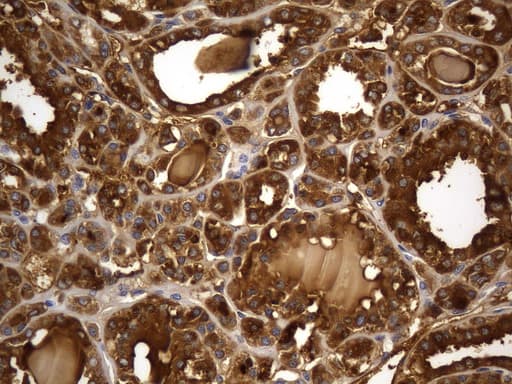 Monoclonal Mouse anti-Human TG / Thyroglobulin Antibody (clone UMAB269, aa20-358, IHC)