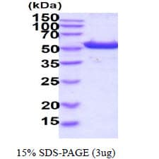 Human ALDH3A1 Protein (Recombinant His)