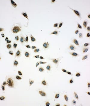 Polyclonal Rabbit anti-Human CACYBP Antibody (aa160-175, IHC, WB)