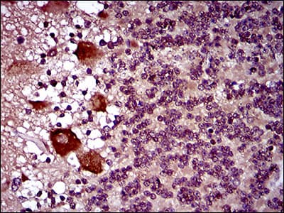 Monoclonal Mouse anti-Human DNM1L / DRP1 Antibody (clone 4E11B11, aa69-213, IHC, WB)