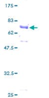 Human ACTB / Beta Actin Protein (Recombinant GST)