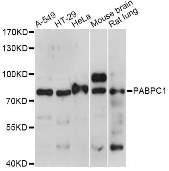 PABPC1 / PABP1 Antibody