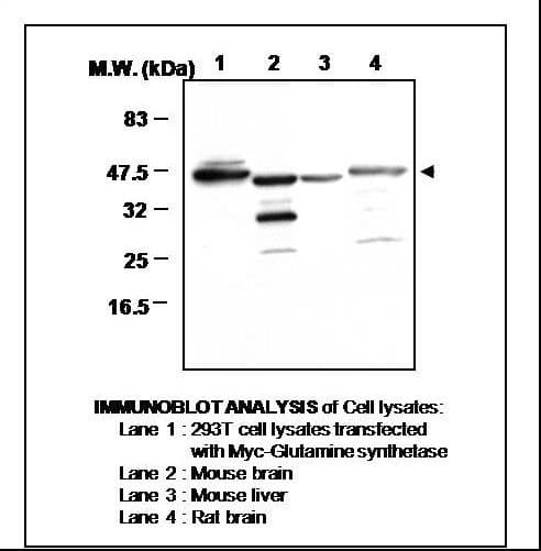 PathPlus™ GLUL / Glutamine Synthetase Antibody