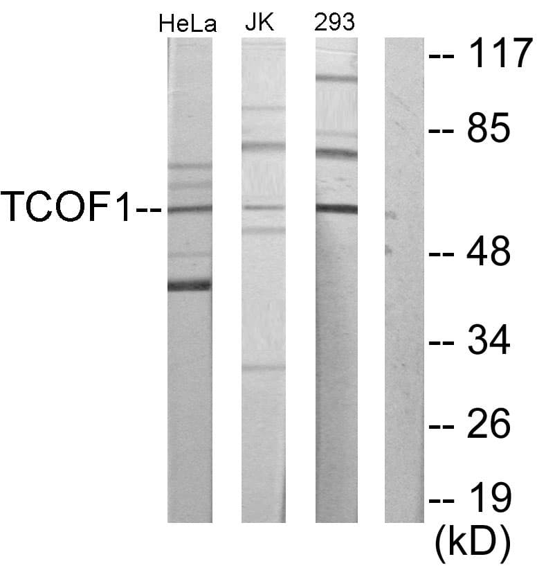 IHC-plus™ Treacle / TCOF1 Antibody (aa41-90)