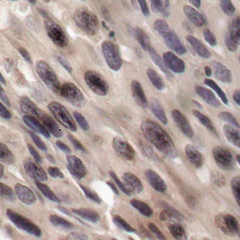 Polyclonal Rabbit anti-Human EIF4EBP1 / 4EBP1 Antibody (phospho-Thr36, IHC, WB)