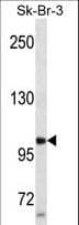 Monoclonal Mouse anti-Human PR / Progesterone Receptor Antibody (aa349-377, WB)