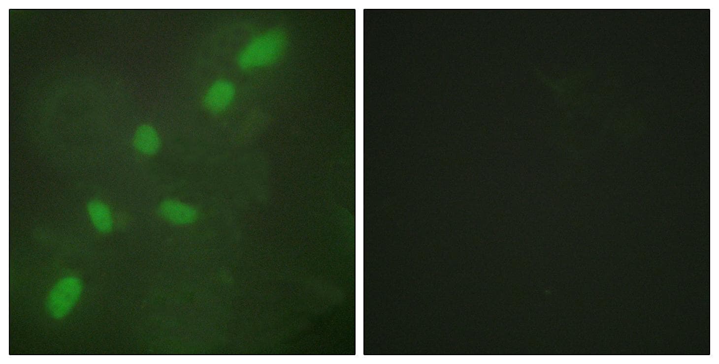 HNRNPA2B1 Antibody