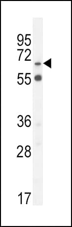 SLC6A12 / BGT-1 Antibody (aa9-38)